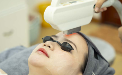 Triệt Lông Full FACE