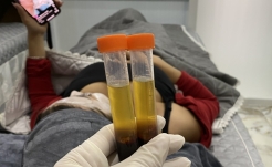 Tiêm PRP Máu tự thân