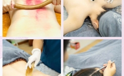 Liệu trình thải độc não bộ